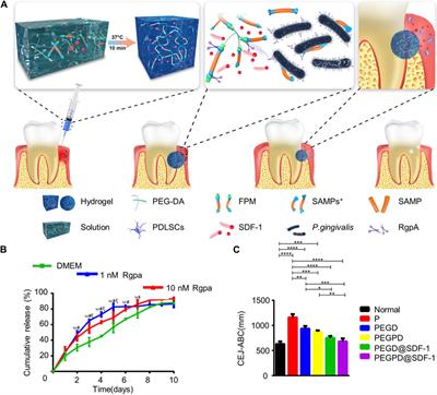 Hydrogels promote periodontal regeneration